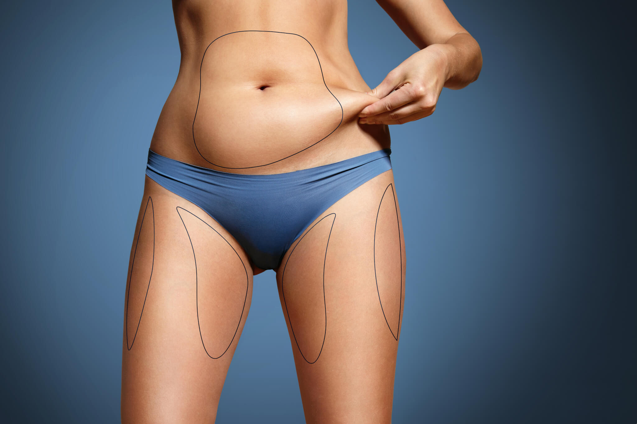 How to best prepare for a CoolSculpting Procedure